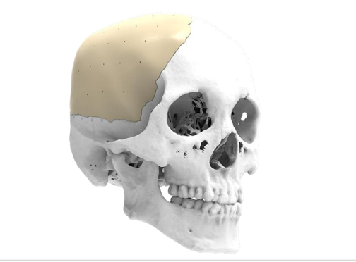 20250430102245 20250430102245
